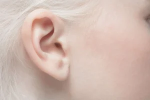 ear closeup 300x200 - چه مواردی ممکن است نشانه‌های عفونت پس از عمل بینی باشند؟